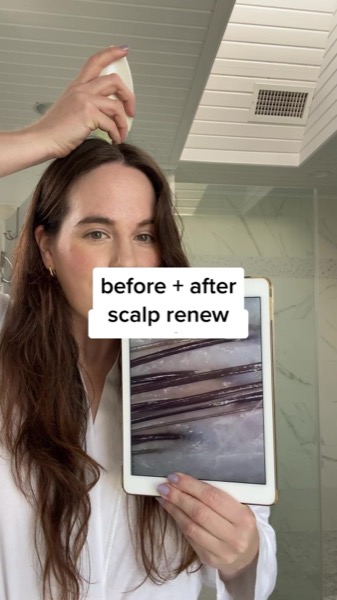 TikTok Post Thumbnail