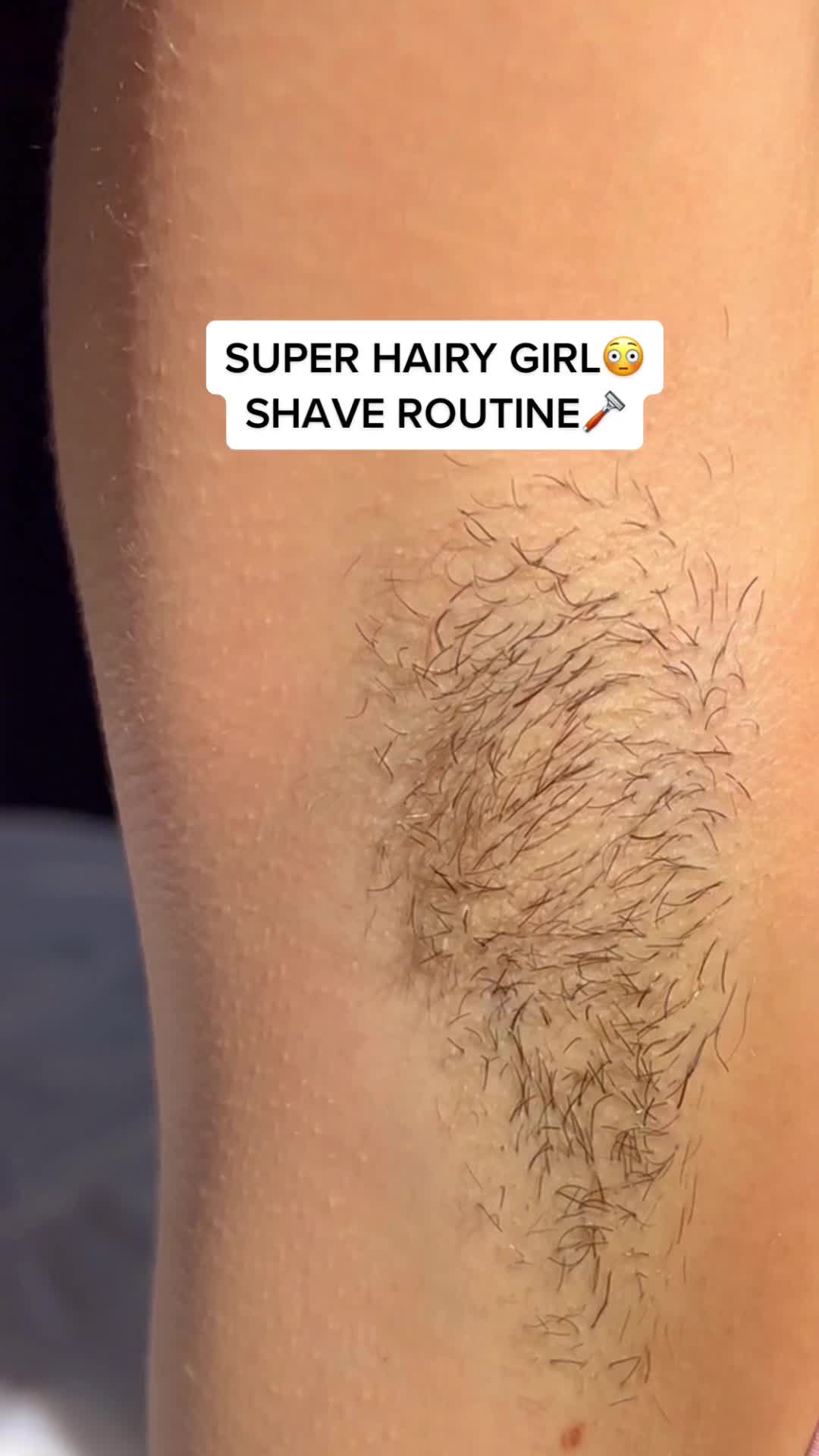 TikTok Post Thumbnail