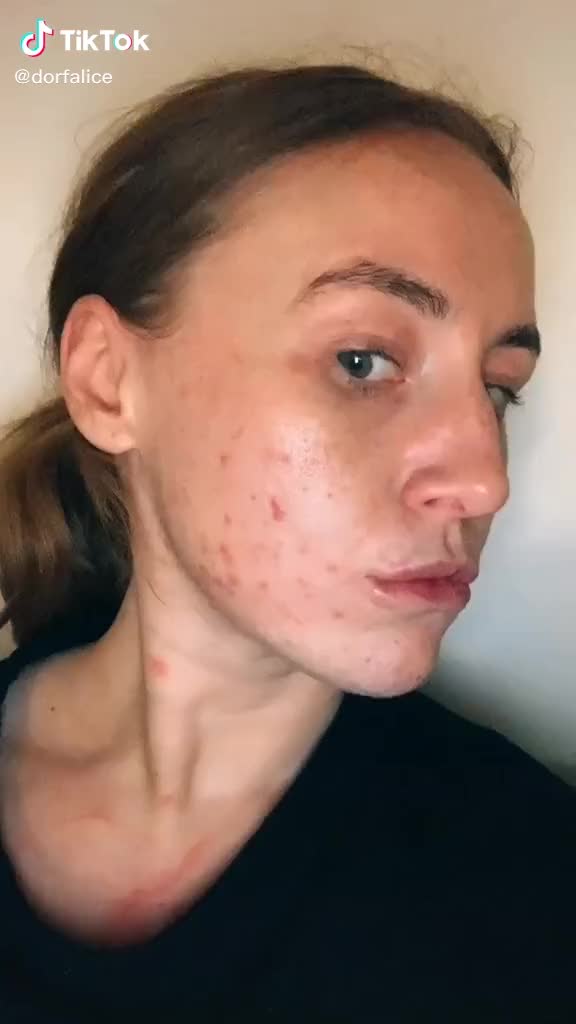 TikTok Post Thumbnail