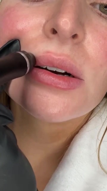 TikTok Post Thumbnail